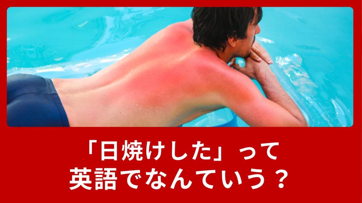「日焼けした」って英語でなんていうの？夏に使える表現を覚えよう！