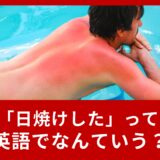 「日焼けした」って英語でなんていうの？夏に使える表現を覚えよう！